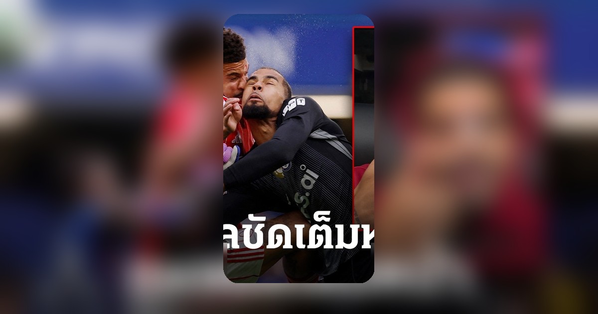 มอร์แกน กิ๊บบ์ส-ไวท์ อัปเดตอาการหลังชนซานเชซ ใบหน้ามีรอยเย็บ
