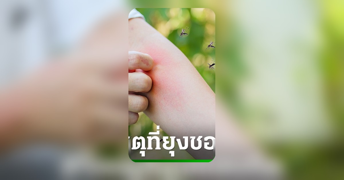 เปิด 6 ปัจจัยที่ทำให้ยุงชอบกัดคุณ พร้อมวิธีแก้คันและป้องกันรอยดำ