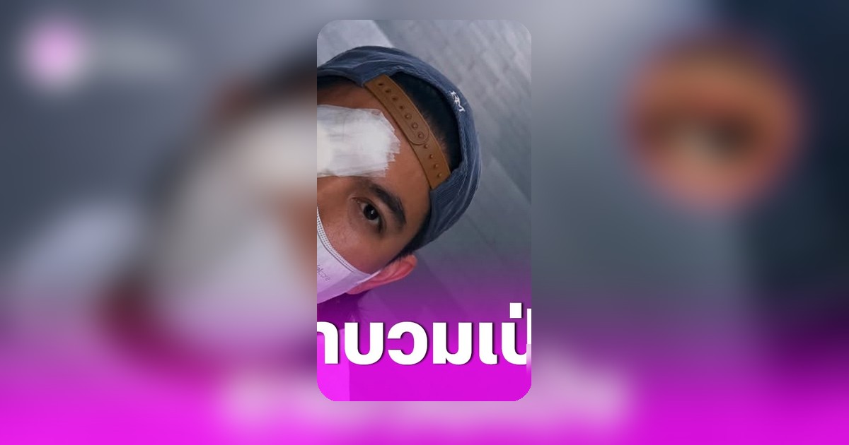 แฟนคลับเป็นห่วงเข้ม หัสวีร์ โพสต์ภาพตาบวมเป่งไม่ทราบสาเหตุ