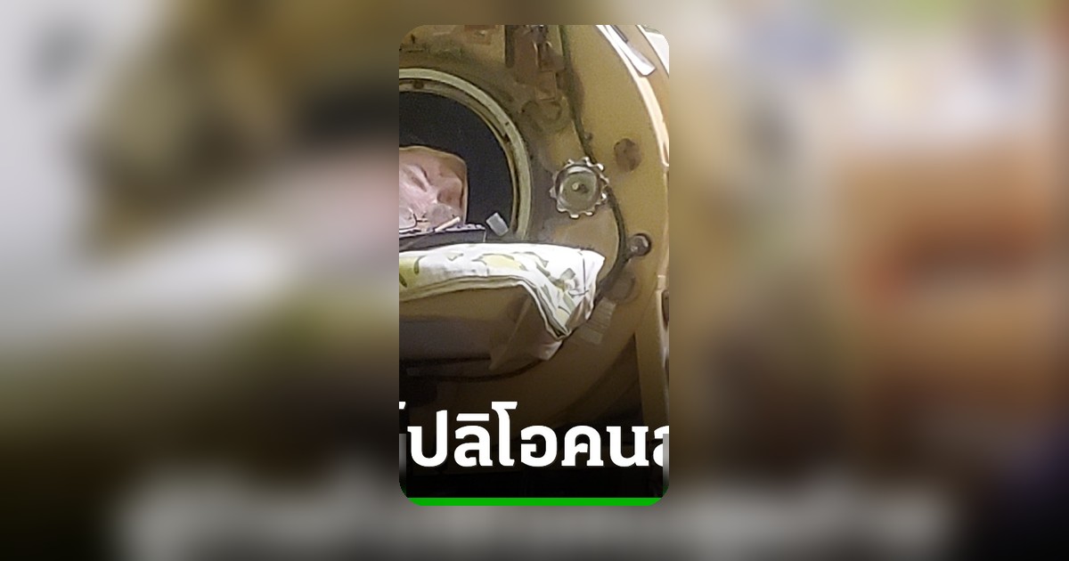 สิ้นตำนาน 'ปอดเหล็ก' ผู้ป่วยโปลิโอคนสุดท้ายสหรัฐฯ เสียชีวิต 78 ปี