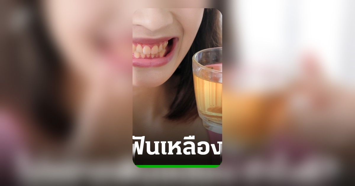 10 อาหารใกล้ตัว ทำฟันเหลืองโดยไม่รู้ตัว เช็กลิสต์ด่วน!