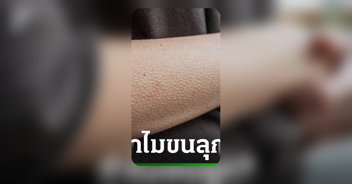 ขนลุกเกิดจากอะไร? 4 สาเหตุหลัก ร่างกายส่งสัญญาณเตือนอะไรบ้าง
