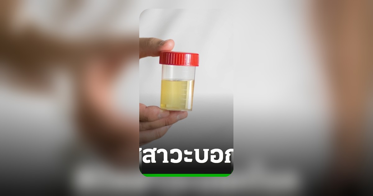 สีปัสสาวะฟ้องสุขภาพ เช็กสัญญาณเตือนก่อนตรวจประจำปี