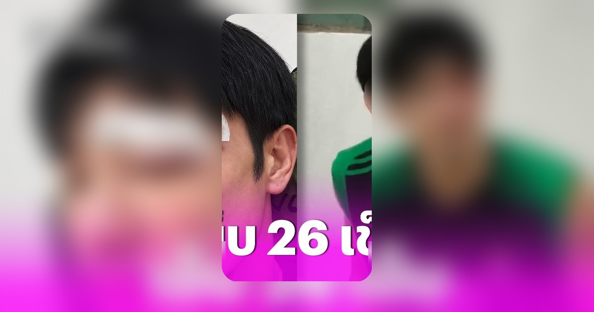 อ้วน รังสิต คิ้วแตกเย็บ 26 เข็ม เผยสาเหตุสุดช็อก